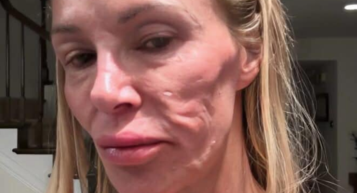 Riesci a Riconoscerla?: I Problemi di Salute Hanno Cambiato Drasticamente il Suo Aspetto!