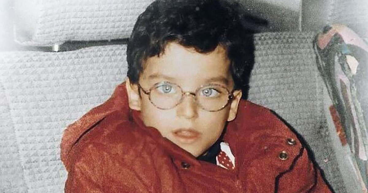 “La storia del brutto anatroccolo”: da bambino strabico e mingherlino… a uomo più bello del mondo!