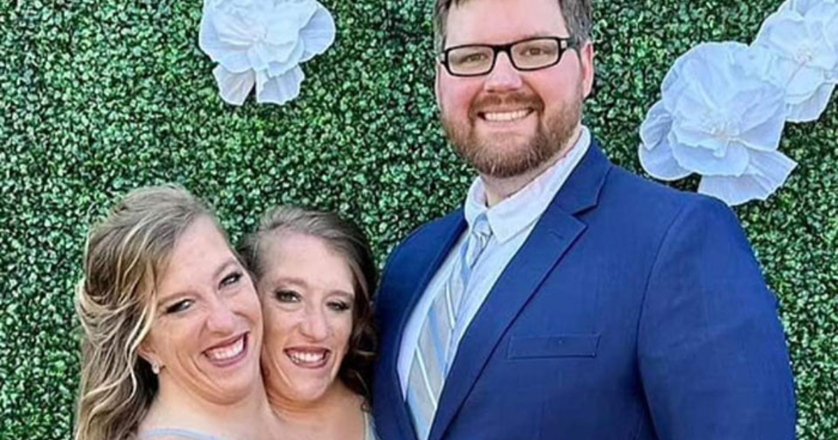 Le gemelle Hensel accolgono un bambino tra scetticismo e domande: è davvero possibile una gravidanza?