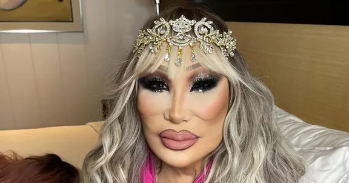 Era un’icona della TV ammirata da tutti: la riconosci prima dell’intervento?