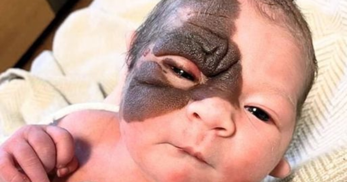 Nata con un segno unico, la straordinaria trasformazione di questa coraggiosa ragazza ti scioglierà il cuore: ecco le sue foto!