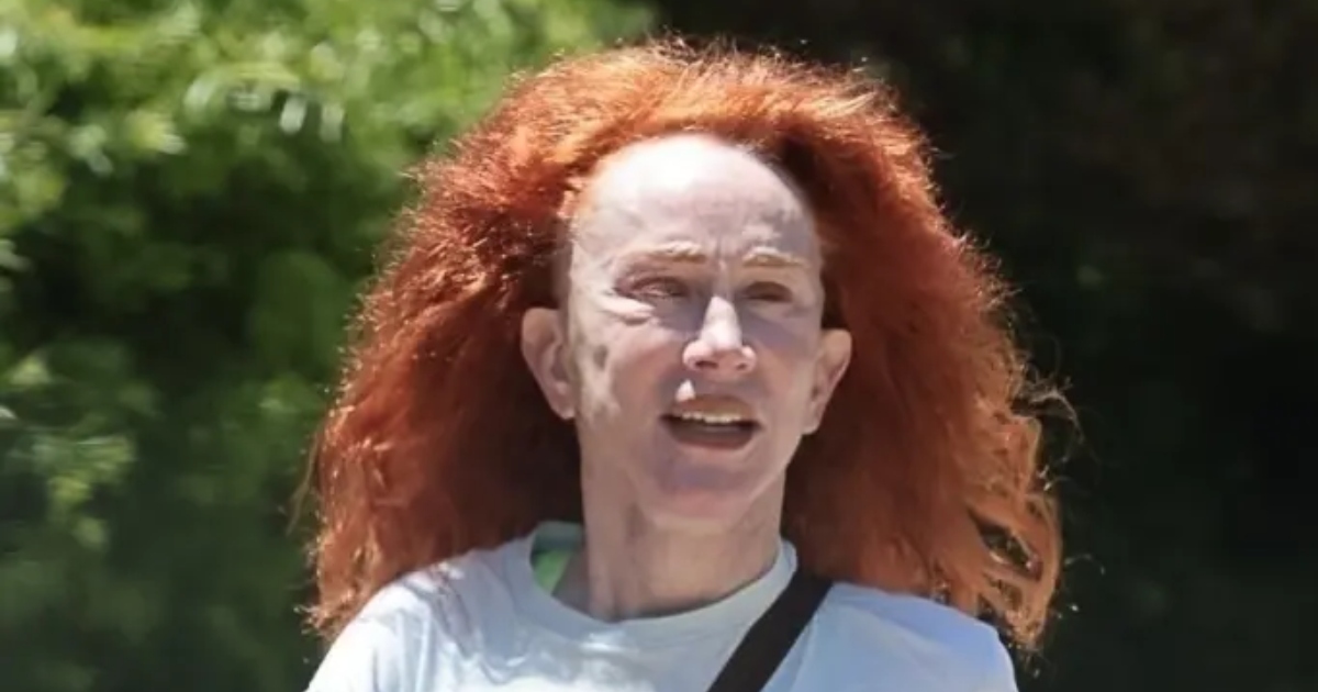 Un tempo una star scandalosa!: Ora quasi irriconoscibile dopo anni di chirurgia