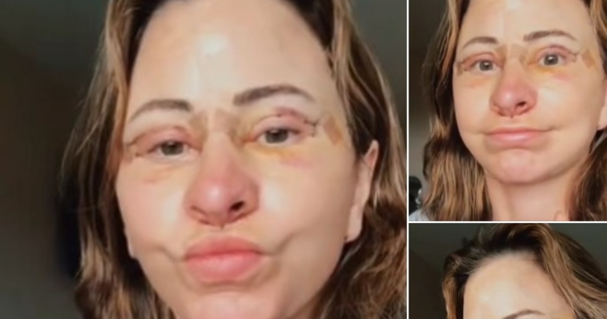 Donna Spende 14.000 Dollari per un Lifting, Vende Casa e Abbraccia la Vita in Van Dopo una Trasformazione Sorprendente!