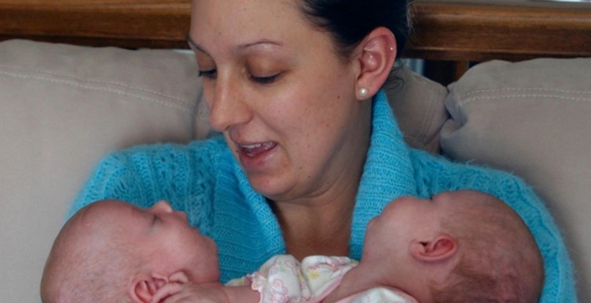 “Operati a soli 6 mesi”: la commovente storia di gemelle siamesi che oggi stanno benissimo insieme!