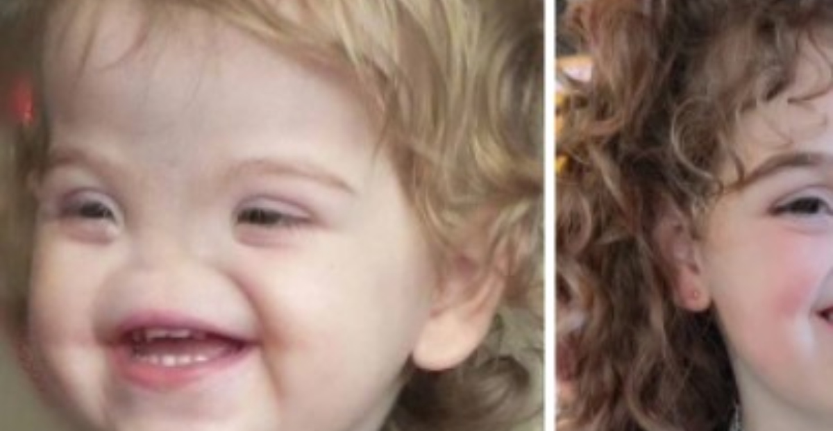 Incontra una ragazza nata senza naso: alcuni la chiamano “Voldemort”, ma in realtà è una ragazza dolcissima!